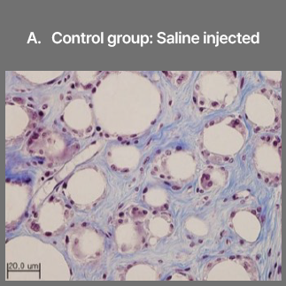 A. Control group: Saline injected